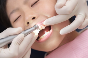 予防歯科について 